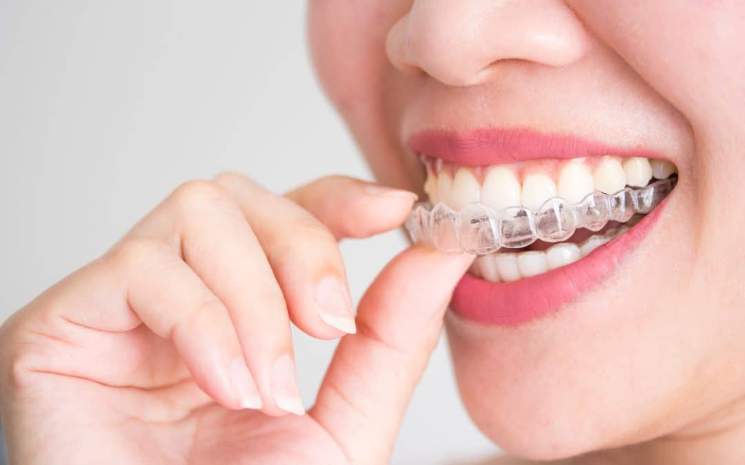 Which Orthodontic Treatment is Right For You?