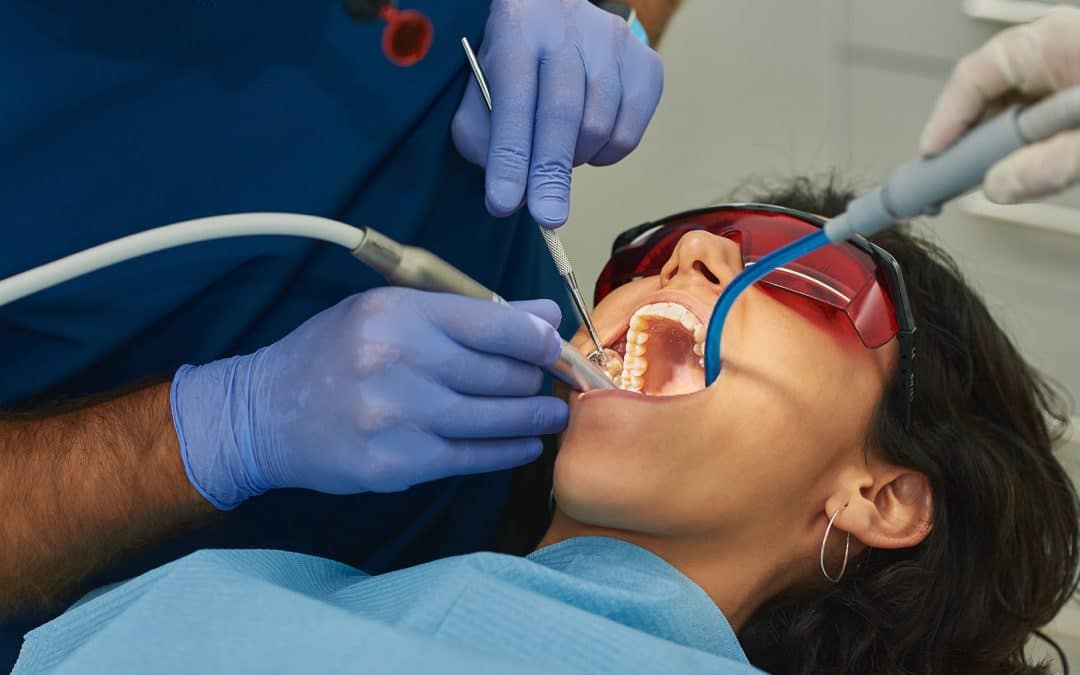 How Often Should You Get a Professional Teeth Cleaning?